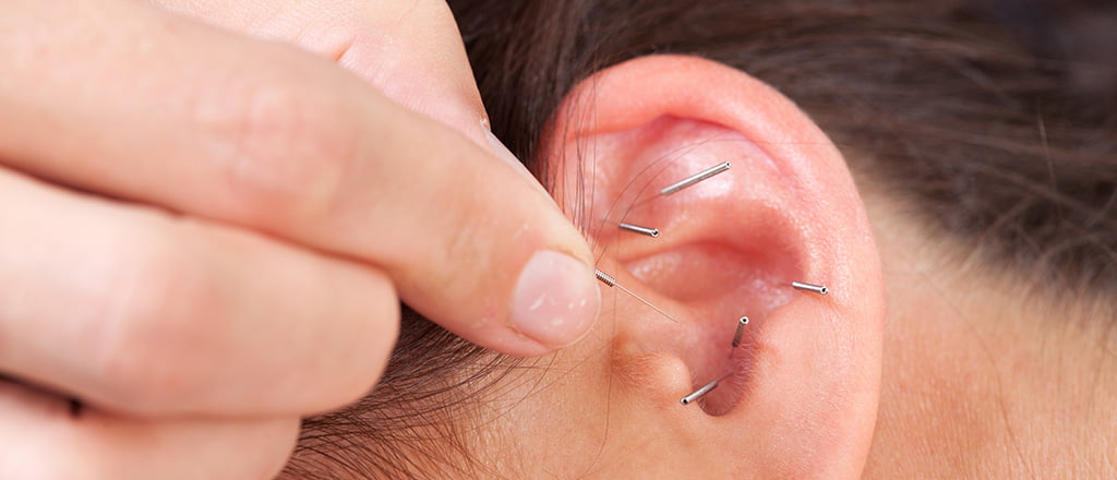 Emagrecendo pela orelha