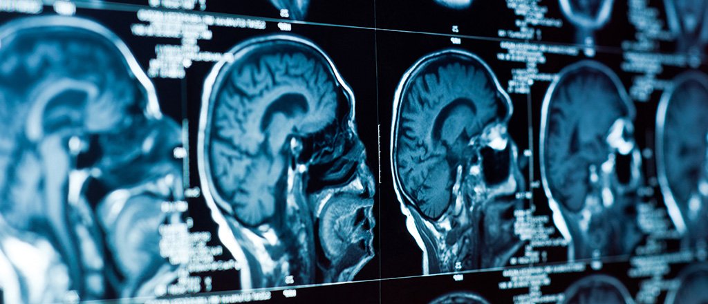 Emagrecendo com a força da mente